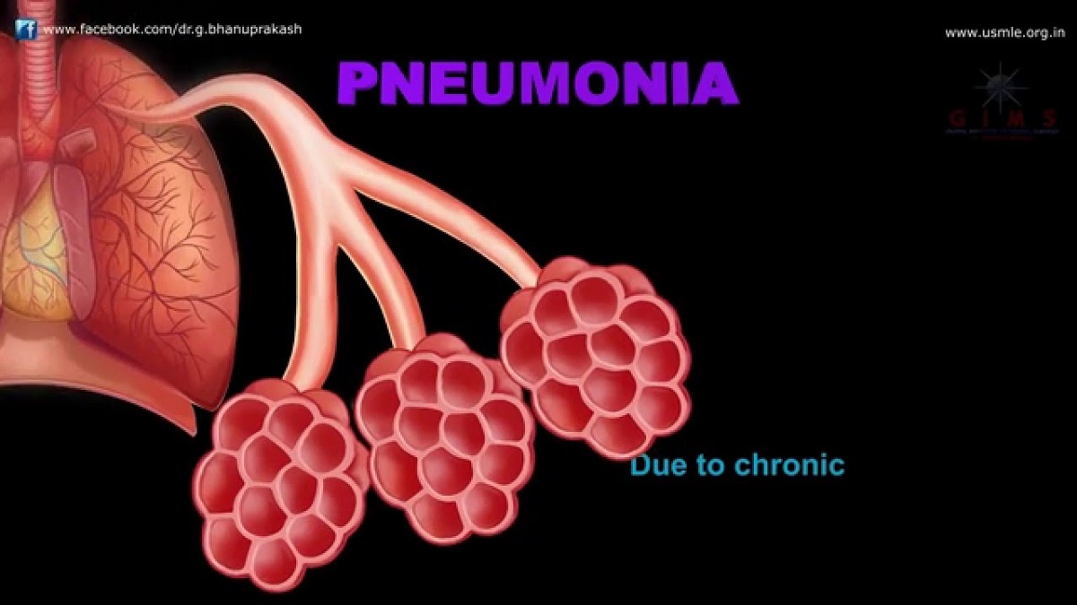 penyakit_pneumonia
