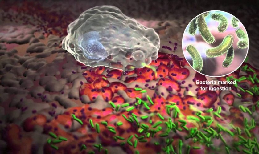 Ciri Ciri Kelebihan Sel Darah Putih - Ini Cirinya